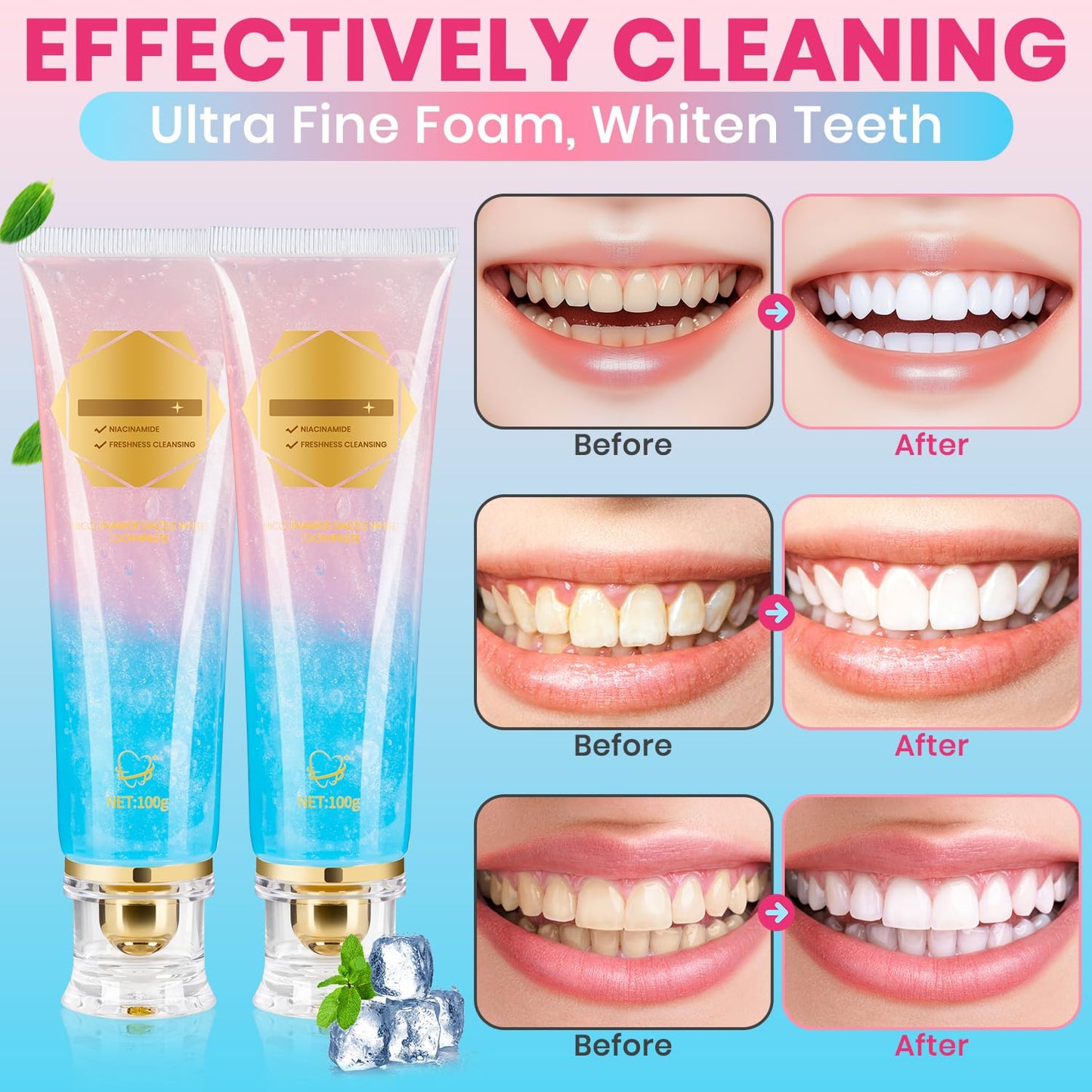 Radiant Smile Whitening Toothpaste
